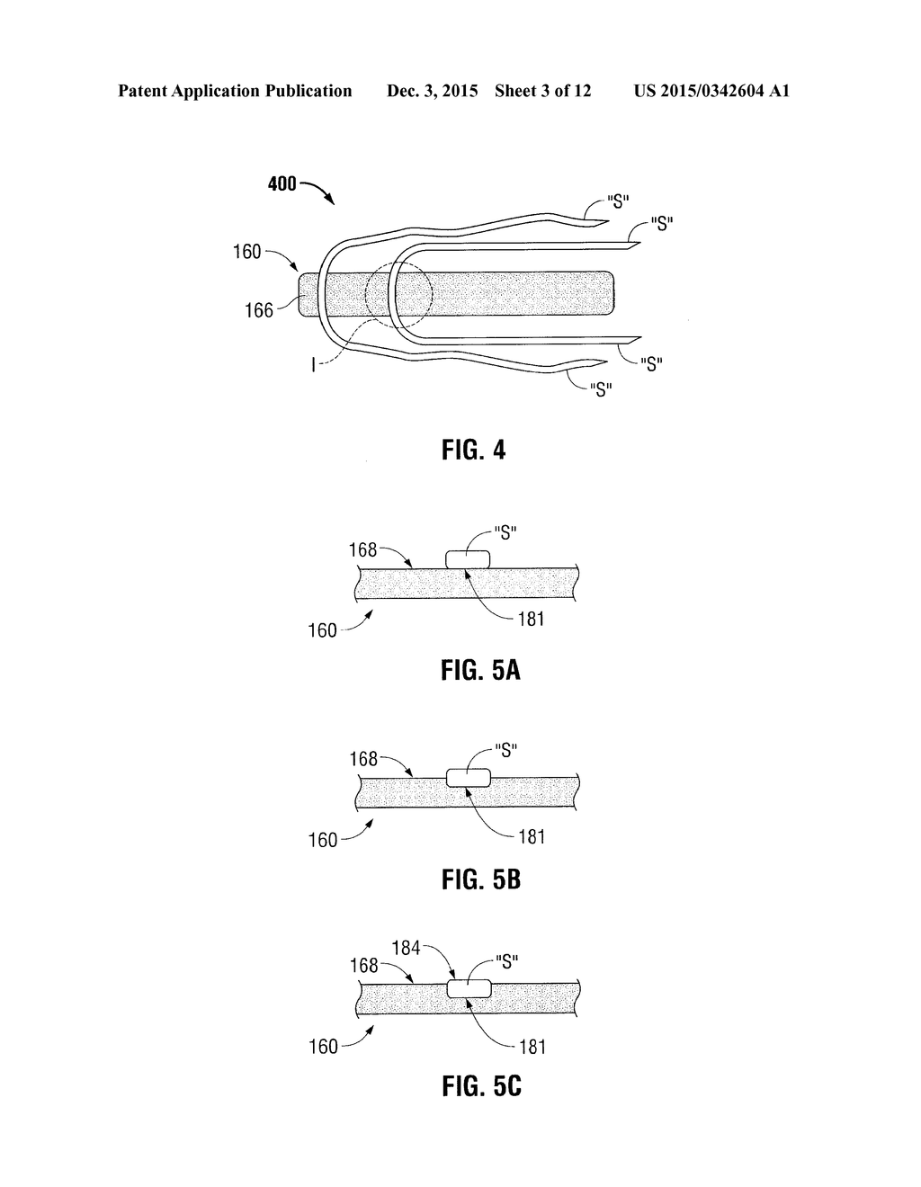 SOFT TISSUE GRAFT PREPARATION DEVICES AND METHODS - diagram, schematic, and image 04