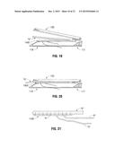 SOFT TISSUE GRAFT PREPARATION DEVICES AND METHODS diagram and image