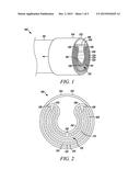 MATERIAL REMOVAL CATHETER HAVING AN EXPANDABLE DISTAL END diagram and image