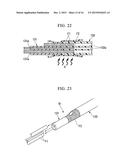 TREATMENT INSTRUMENT FOR ENDOSCOPE AND ENDOSCOPE SYSTEM diagram and image