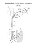 TREATMENT INSTRUMENT FOR ENDOSCOPE AND ENDOSCOPE SYSTEM diagram and image