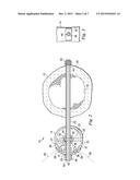 Bone Fixation System and Method of Use diagram and image