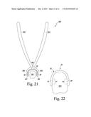 METATARSAL FIXATION DEVICE, SYSTEM AND METHOD diagram and image