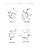 SURGICAL INSTRUMENT FOR REMOVING AN IMPLANTED OBJECT diagram and image