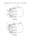 SURGICAL INSTRUMENT FOR REMOVING AN IMPLANTED OBJECT diagram and image