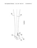 SYSTEMS AND METHOD FOR PROTECTION OF OPTICAL SYSTEM OF LASER-BASED     APPARATUS diagram and image