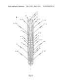 STENT FOR THE POSITIONING AND ANCHORING OF A VALVULAR PROSTHESIS IN AN     IMPLANTATION SITE IN THE HEART OF A PATIENT diagram and image