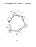 STENT FOR THE POSITIONING AND ANCHORING OF A VALVULAR PROSTHESIS IN AN     IMPLANTATION SITE IN THE HEART OF A PATIENT diagram and image