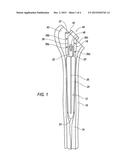 SHOULDER ENDOPROSTHESIS diagram and image