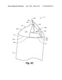 BONE HARVESTER AND BONE MARROW REMOVAL SYSTEM AND METHOD diagram and image