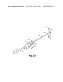 BONE HARVESTER AND BONE MARROW REMOVAL SYSTEM AND METHOD diagram and image