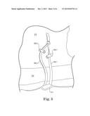 REUSABLE DIAPER diagram and image