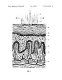 COMBINED SYSTEMIC AND TOPICAL TREATMENT OF DISORDERED TISSUES diagram and image