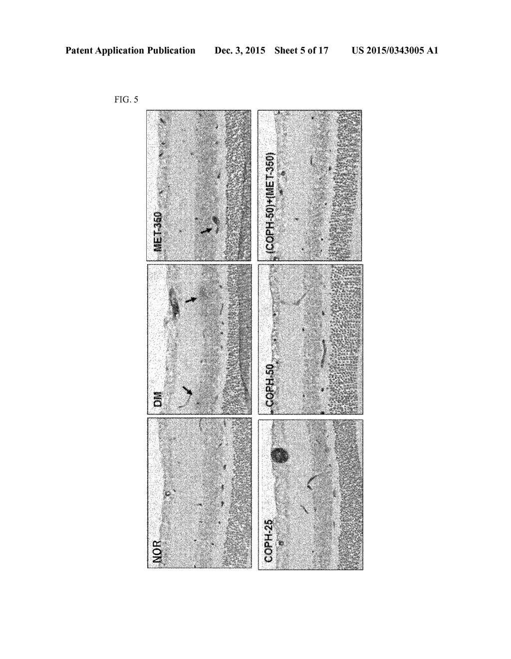 PHARMACEUTICAL COMPOSITION AND FUNCTIONAL FOOD COMPRISING NATURAL EXTRACTS     FOR PREVENTING OR TREATING DIABETIC COMPLICATIONS OR ANGIODEMA - diagram, schematic, and image 06