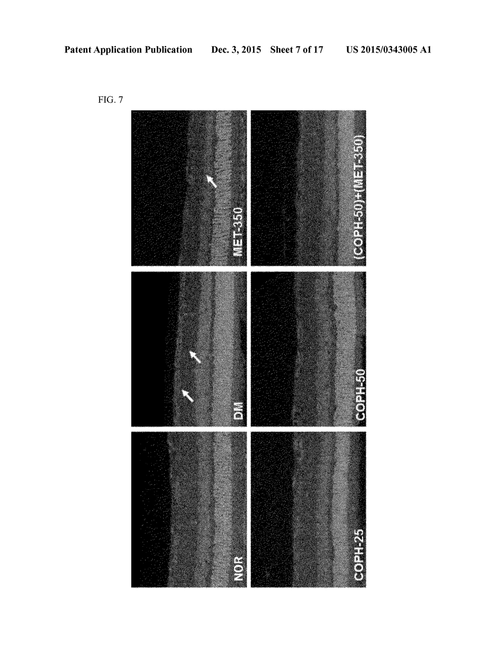 PHARMACEUTICAL COMPOSITION AND FUNCTIONAL FOOD COMPRISING NATURAL EXTRACTS     FOR PREVENTING OR TREATING DIABETIC COMPLICATIONS OR ANGIODEMA - diagram, schematic, and image 08