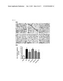 PHARMACEUTICAL COMPOSITION AND FUNCTIONAL FOOD COMPRISING NATURAL EXTRACTS     FOR PREVENTING OR TREATING DIABETIC COMPLICATIONS OR ANGIODEMA diagram and image