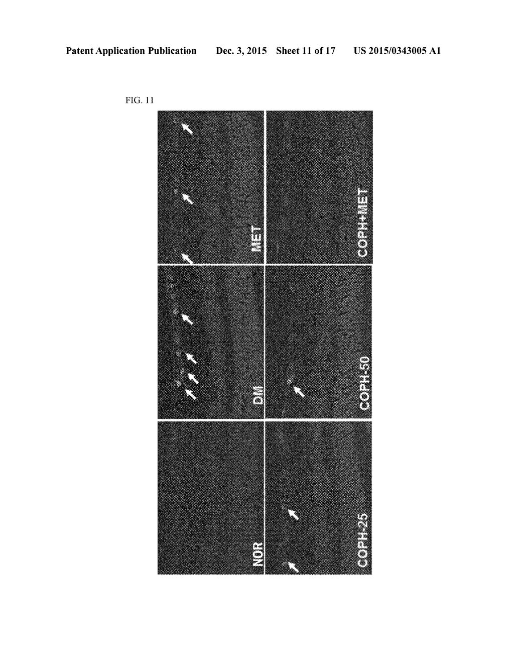 PHARMACEUTICAL COMPOSITION AND FUNCTIONAL FOOD COMPRISING NATURAL EXTRACTS     FOR PREVENTING OR TREATING DIABETIC COMPLICATIONS OR ANGIODEMA - diagram, schematic, and image 12