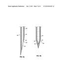 IMPROVED URETERAL STENT AND METHOD FOR TREATING UROLOGICAL PROBLEMS diagram and image