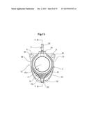 LIQUID MEDICINE INJECTION DEVICE OF SUBCUTANEOUS IMPLANT TYPE diagram and image