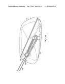 INFUSION SET IMPROVEMENTS diagram and image