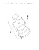 INFUSION SET IMPROVEMENTS diagram and image