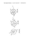 INFUSION SET IMPROVEMENTS diagram and image