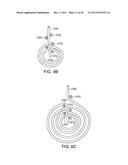 INFUSION SET IMPROVEMENTS diagram and image