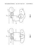 DUAL CUSHION AIRBAG WITH INDEPENDENT INFLATION diagram and image