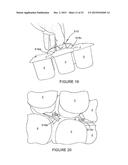 PACKAGE WITH CARRYING HANDLE AND BLANK FOR FORMING THE HANDLE diagram and image