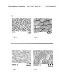 POLYURETHANE-BASED EXPANDABLE POLYMER PARTICLES diagram and image