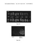 System For Expression Of Genes In Plants From A Virus-Based Expression     Vector diagram and image