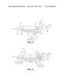 Multi Stage Air Flow Management diagram and image