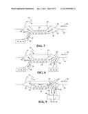 Multi Stage Air Flow Management diagram and image