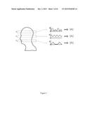 Magnetic Resonance Fingerprinting (MRF) With Simultaneous Multivolume     Acquisition diagram and image