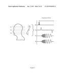 Magnetic Resonance Fingerprinting (MRF) With Simultaneous Multivolume     Acquisition diagram and image
