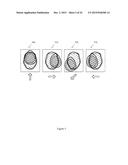 Magnetic Resonance Fingerprinting (MRF) With Simultaneous Multivolume     Acquisition diagram and image