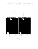 Magnetic Resonance Fingerprinting (MRF) With Simultaneous Multivolume     Acquisition diagram and image