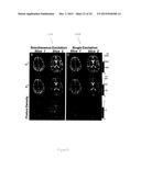 Magnetic Resonance Fingerprinting (MRF) With Simultaneous Multivolume     Acquisition diagram and image