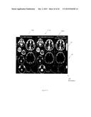 Magnetic Resonance Fingerprinting (MRF) With Simultaneous Multivolume     Acquisition diagram and image