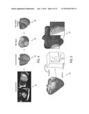 METHOD AND SYSTEM FOR INTERACTIVE COMPUTATION OF CARDIAC ELECTROMECHANICS diagram and image