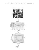 METHOD AND SYSTEM FOR INTERACTIVE COMPUTATION OF CARDIAC ELECTROMECHANICS diagram and image