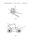 METHOD AND SYSTEM FOR OPTIMIZATION OF AN EXSANGUINATION TOURNIQUET diagram and image