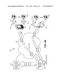 SMART LUG SYSTEM diagram and image