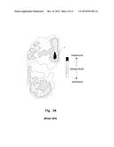 In-Shoe Support Device For Heeled Shoes diagram and image