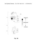 In-Shoe Support Device For Heeled Shoes diagram and image