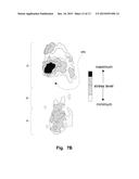 In-Shoe Support Device For Heeled Shoes diagram and image