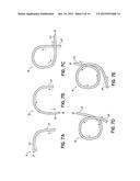 METHOD AND DEVICE FOR EVALUATING A COLONOSCOPY PROCEDURE diagram and image