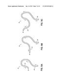 METHOD AND DEVICE FOR EVALUATING A COLONOSCOPY PROCEDURE diagram and image