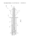 A SEALING DEVICE FOR COLONOSCOPY PROCEDURE diagram and image