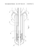 A SEALING DEVICE FOR COLONOSCOPY PROCEDURE diagram and image